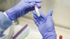 Τρεις εξηγήσεις δίνει ο Λύτρας για τη νέα έξαρση του κορονοϊού Ροή Ειδήσεων