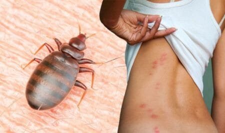 Στο Παρίσι έχει ξεσπάσει επιδημία κοριών – Ακολουθούν συμβουλές ειδικών για το πώς να προστατευτείτε ενώ ταξιδεύετε.