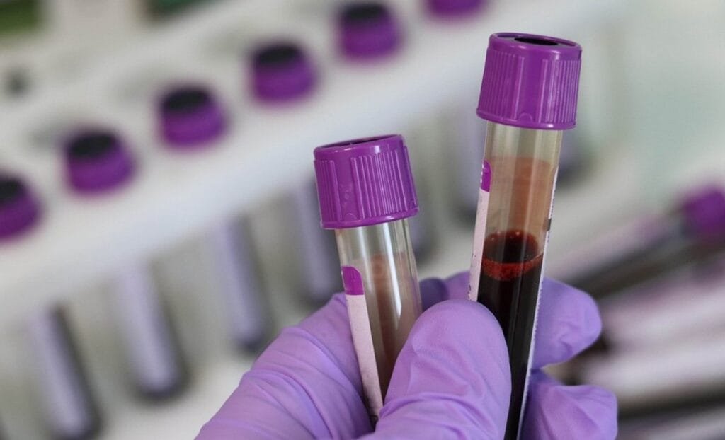 Πόσο κοντά βρίσκονται οι επιστήμονες στην παραγωγή τεχνητού αίματος;