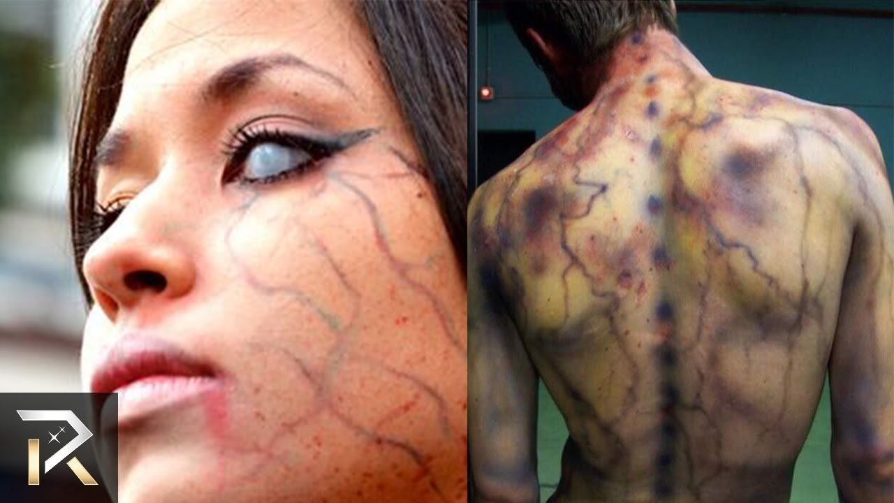 youtube placeholder image